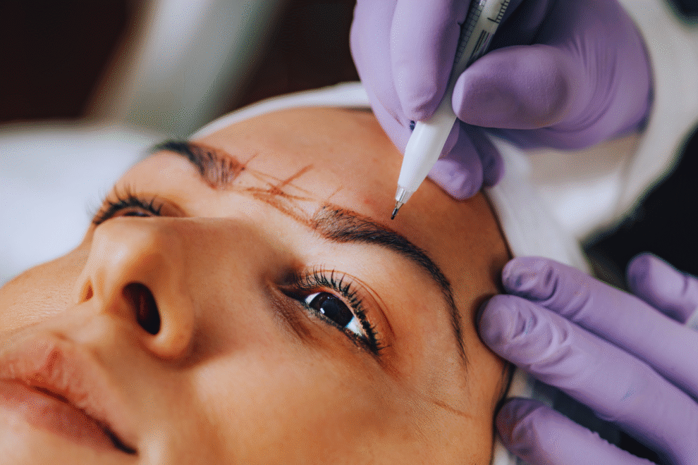 Uma pessoa recebe marcações nas sobrancelhas com uma caneta como parte de um procedimento de nanoblading sobrancelha; mãos usando luvas roxas seguram seu rosto com firmeza.
